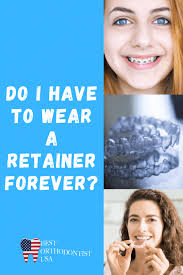 How long a retainer last depends on which retainer type you have, as well as how well you care for the retainer. Can Invisalign Be Used As A Retainer