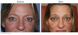 Wolf's Rejuvenation Center, 1 Marty Ln, West Alexandria, OH 45381, US