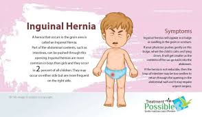 Image result for Inguinal hernia child