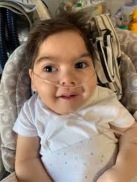 Rare gene mutation can't keep patient from smiling