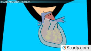 Fluid backup in the lungs can cause shortness of breath with exercise or difficulty breathing at rest or when lying flat in bed. Pericardial Effusion Causes Treatment Video Lesson Transcript Study Com