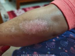Organic argania spinosa (argan) oil. Mrs Secretary Hilangkan Parut Dengan Minyak Vitamin E Cosmoderm