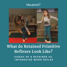 What Do Retained Primitive Reflexes Look Like