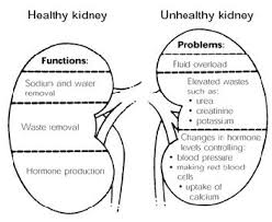 By Kimberly Allen Rn In The Past Chronic Kidney Disease Or Ck D Went By Other Names Like Chronic Renal Failure A Dialysis Nurse Nursing School Survival Nurse