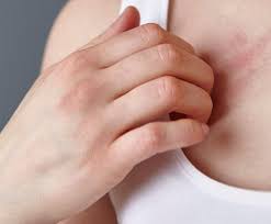 Learn about rash types, treatment, causes, symptoms, diagnosis, and prevention. Coronavirus Patients Suffering Nasty Red Rash Before Covid 19 Symptoms