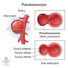 Image result for Pseudoeriosema