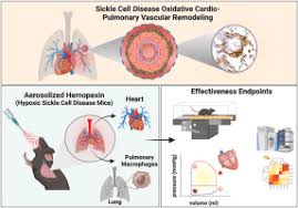 Targeting lung heme iron by aerosol hemopexin adminstration in sickle cell  disease pulmonary hypertension