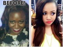 Black And White Bleaching Cream Before And After Pin On Celebrity Latest Photos