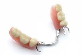 What is a removable partial denture and how does it work? Removable Partial Dentures How Does It Work United Dentist