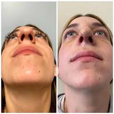 John Lazor MD (@drjohnlazor) · Weymouth, MA