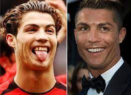 Ronaldo was the youngest child among four children; Pin On Veneers Lake Worth Florida