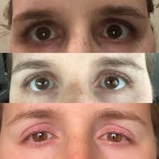 My sister is the one who got the lashes; Lash Boost November 2018 Babies Forums What To Expect