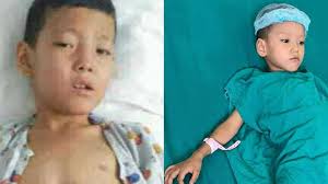 Fundraiser by Sujita Tamang : “Give Hope to Two Young Brothers in Their  Toughest Battle”