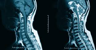 Image result for CT Intravenous Contrast