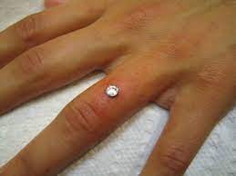 Finger Dermal Peircing If Only I Didnt Use My Hand So Much Beauty Tatouage