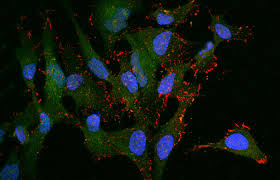 Check spelling or type a new query. How Ai Can Detect Cervical Cancer Medical Design And Outsourcing