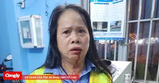 Bị đánh gãy xương mũi khi đang làm nhiệm vụ gác chắn tàu