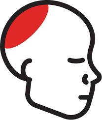 What Your Headache Is Telling You Advent Knows