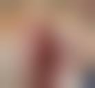 Image result for Chest Trauma