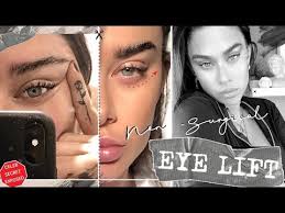 All eye lift surgery photos are of patients of prasad cosmetic surgery, with offices in garden city, long island, ny and midtown manhattan, near grand central station. Non Surgical Eye Lift Celebrity Beauty Secret Youtube
