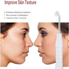 Amazon.com: High Frequency Facial Wand/Machine with 5 Argon Parts Skin Care  Tool for Wrinkles Reducing Face Skin Tightening. : Beauty & Personal Care