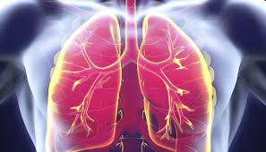 Penyakit ini kerap kali menyebabkan seseorang kanak. Pneumonia Lebih Mudah Berjangkit Di Hospital Ini 10 Fakta Radang Paru Paru Anda Perlu Ambil Tahu Famili Mstar
