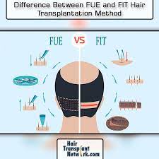 Difference Between Fue And Fit Hair Transplantation Method Hair Transplantation Hair Transplant Surgery Medical Prescription