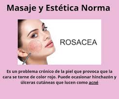 Masaje y Estética Norma Villa Pueyrredón (@masajeyestetica_norma_pueyrred)  · Villa Pueyrredón