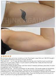 Not just fading of the tattoo. Laser Tattoo Removal Sydney The 1 Rated Tattoo Removal Clinic