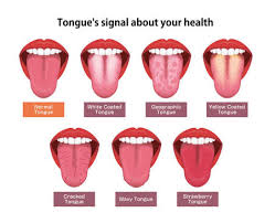Mar 25, 2021 · when candida albicans overgrows in the mouth and throat, thrush develops. 214 Oral Thrush Stock Photos And Images 123rf
