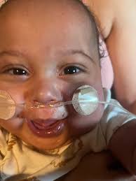 Amari successfully removed his tube this afternoon