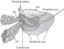 Have shown that the majority of prostate cancer originates in the peripheral zone (pz, at the prostate posterior periphery), as opposed to the transition zone (tz, in the central anterior. Where The Cancer Is In Your Prostate May Really Matter Sometimes The New Prostate Cancer Infolink