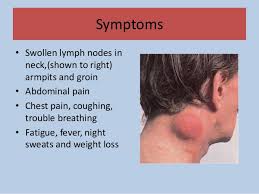 How and when to treat armpit pain faqs about armpit pain references. Right Gastric Lymph Nodes Gerd Cough Nocturnal Ict Accordance Option