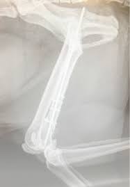 Dette kan være meget nyttig, blant annet i diagnostisering av idrettskader eller som i dette bildet; Smadyrkirurgi Redesign