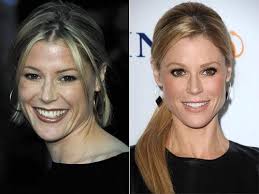 Julie Bowen Plastic Surgery Possible Facelift Nose Job Celebrity Plastic Surgery Plastic Surgery Julie Bowen
