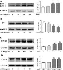 A large archive of magazines from magazines pdf true pdf, download and read magazines online. Involvement Of Pink1 Parkin Mediated Mitophagy In Age Induced Cardiomyocyte Aging International Journal Of Cardiology