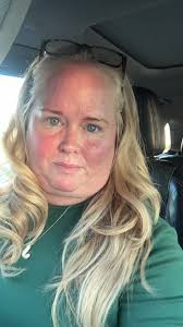 Trying red light therapy for MCAS & histamine flares 🌱🧠 ”MCAS #Hi...