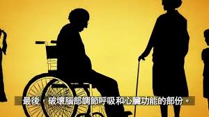 The site owner hides the web page description. èªè­˜é˜¿èŒ²æµ·é»˜ç—‡ å¤±æ™ºç—‡ è€äººç—´å'†ç—‡ Youtube