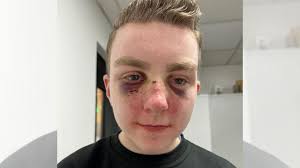 Family of young man with disability attacked in Portadown say they're  living in fear