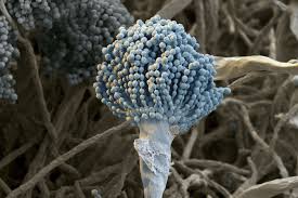 Aspergillosis is a fungal infection caused by certain types of mold. Aspergillosis Causes Types And Treatment The Pharmaceutical Journal