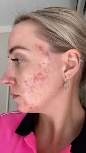 Flounce Cosmetic & Dermatology