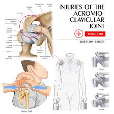 Image result for Fall on Shoulder