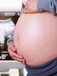 Penyebab perut begah saat hamil. Penyebab Perut Keras Saat Hamil Kumparan Com