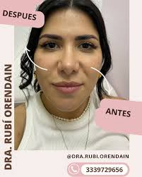 Dra Rubí Orendain Salcedo (@dra.rubi.orendain) · Instagram 照片和视频