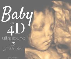 A Sneak Peek At Baby Via 4d Ultrasound At 32 Weeks 4d Ultrasound Baby Ultrasound Ultrasound