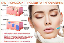 Lingkaran hitam di mata adalah perubahan warna kulit menjadi lebih gelap di bawah mata. Cara Menghilangkan Lingkaran Hitam Di Bawah Mata Di Rumah Kosmetologi Plastik