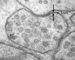 Check spelling or type a new query. Introduction To Electron Microscopy Advanced Microscopy Imaging Facilities The University Of Utah