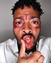 David Boom Quins (@davidboom) • Instagram photos and videos