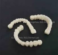 Pfm Tooth Bridge Porcelain Fused to Metal (Cobalt chrome alloy) Good  Biological Compatibility, High Strength, Economical, Cost-Effective.