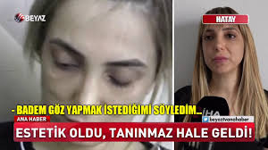 Estetik Oldu Taninmaz Hale Geldi Youtube